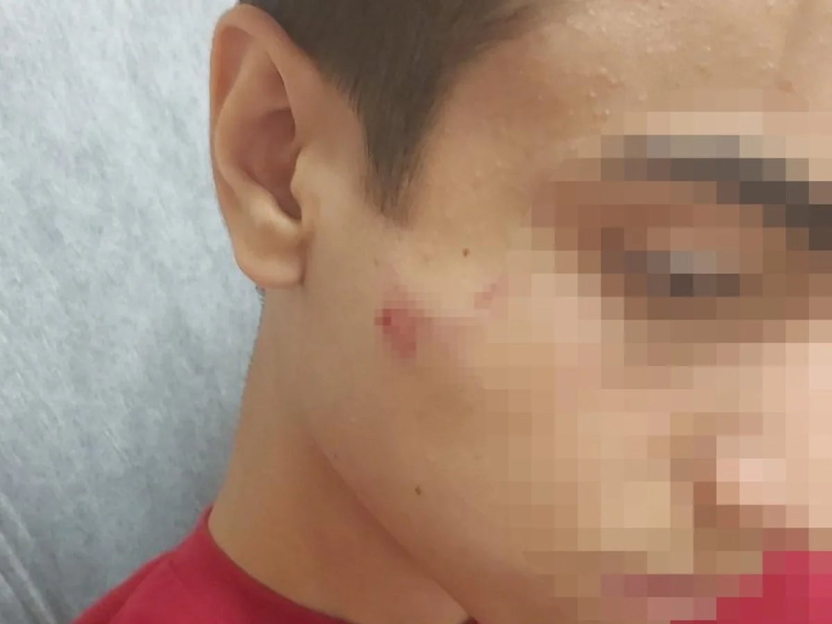 Akran zorbalığı bitmiyor! Demir sopalı saldırıya uğrayan öğrenci yaralandı