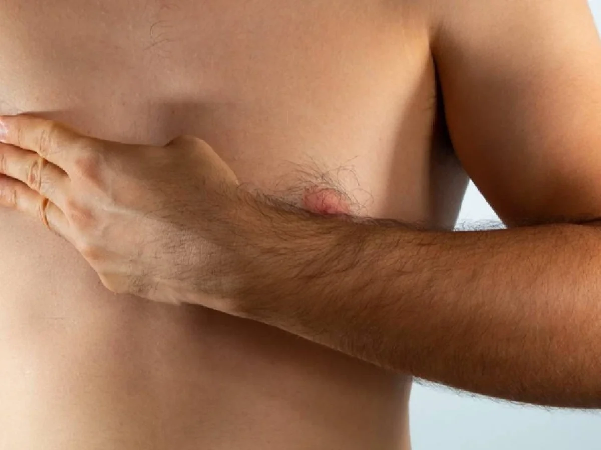 "Erkeklerde de meme kanseri görülebilir"