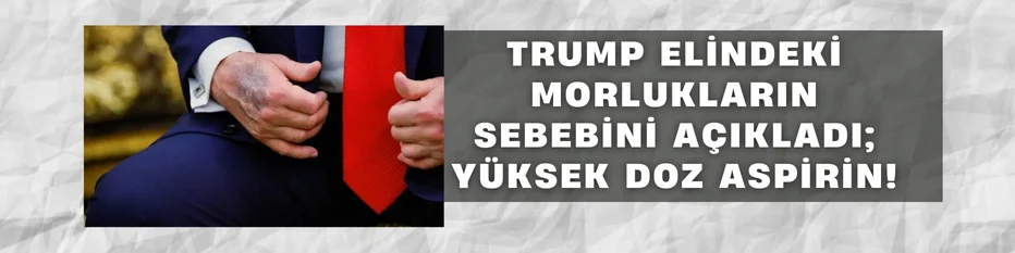 Trump elindeki morlukların sebebini açıkladı; yüksek doz aspirin!