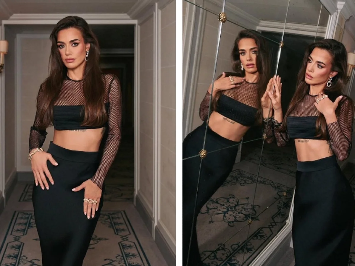 Bensu Soral'ın yüzünün son hali dikkat çekti